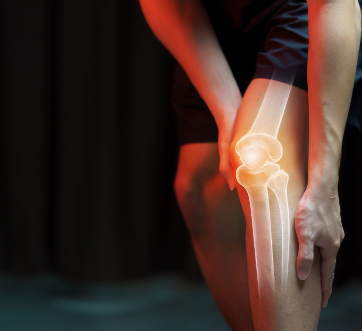 How to Maintain Healthy Joints Naturally: Tips and Tricks