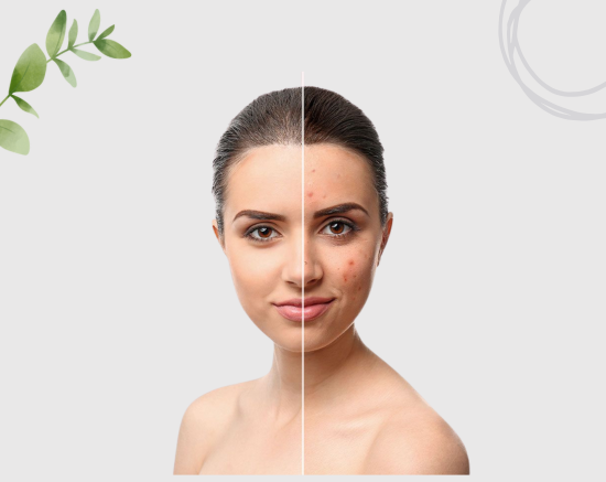 Improves Skin Health