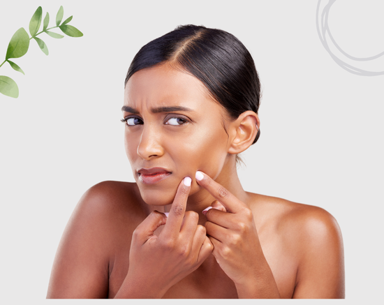 Treat Acne and Pimple